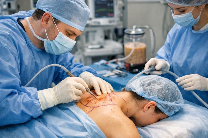 Липосакция холки на шее