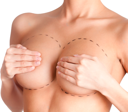 Маммопластика