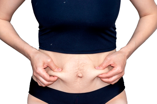 Диастаз без шрамов