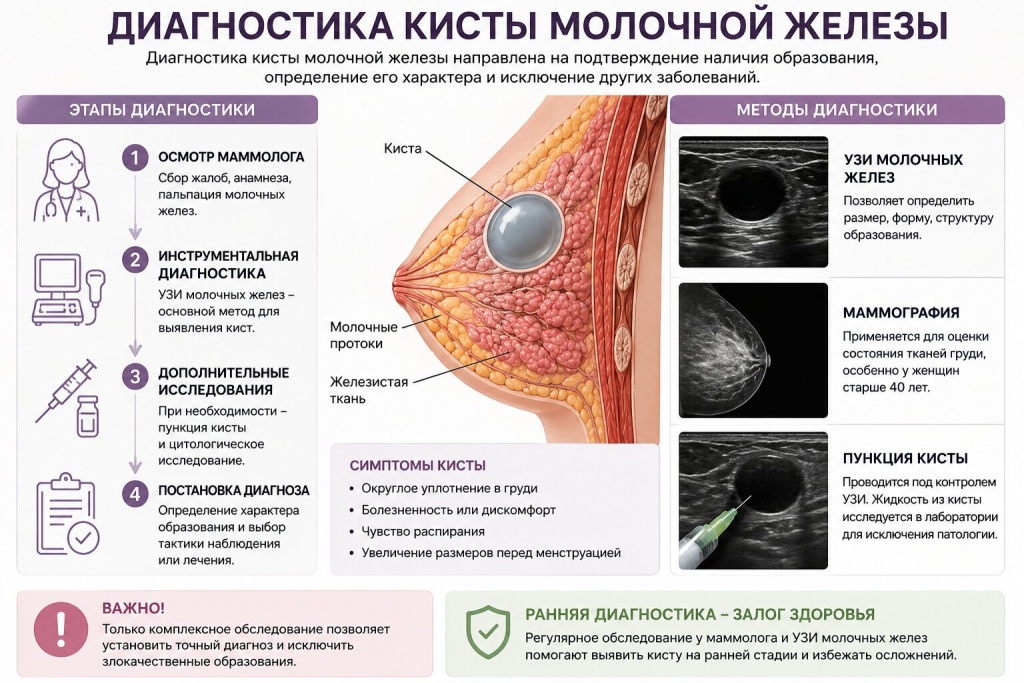 Киста молочной железы - диагностика